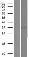 WDR58 (THOC6) Human Over-expression Lysates NM_001142350
