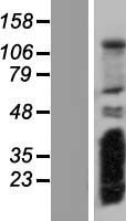CPLANE2 Human Over-expression Lysates NM_030907