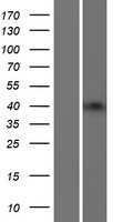 B3GNT4 Human Over-expression Lysates NM_030765
