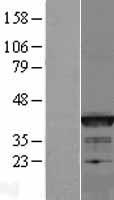 Bcl G (BCL2L14) Human Over-expression Lysates NM_138722