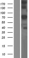 ls079411 glb1l human over expression lysates nm 024506 wb testing 1