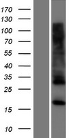 CYBC1 Human Over-expression Lysates NM_001100407