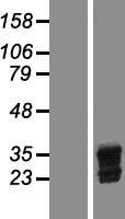Livin (BIRC7) Human Over-expression Lysates NM_022161