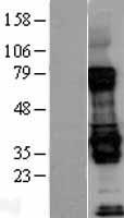 Livin (BIRC7) Human Over-expression Lysates NM_139317