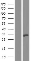 ULBP3 Human Over-expression Lysates NM_024518
