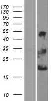 NKAIN1 Human Over-expression Lysates NM_024522