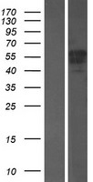 EPS8 like protein 3 (EPS8L3) Human Over-expression Lysates NM_024526