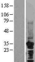 HRPT2 (CDC73) Human Over-expression Lysates NM_024529