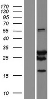 SPAG16 Human Over-expression Lysates NM_001025436