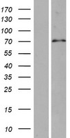 SPAG16 Human Over-expression Lysates NM_024532