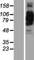CORO7 Human Over-expression Lysates NM_024535