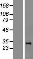 MRPL24 Human Over-expression Lysates NM_145729