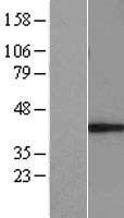 E3 ubiquitin protein ligase MUL1 (MUL1) Human Over-expression Lysates NM_024544