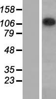 SAP130 Human Over-expression Lysates NM_024545