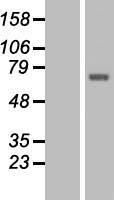 TCTN1 Human Over-expression Lysates NM_024549