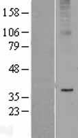 Adiponectin Receptor 2 (ADIPOR2) Human Over-expression Lysates NM_024551