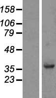FAM118B Human Over-expression Lysates NM_024556