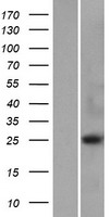 METTL21D (VCPKMT) Human Over-expression Lysates NM_024558