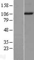 NARG1L (NAA16) Human Over-expression Lysates NM_024561
