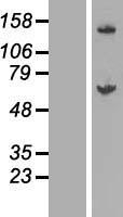 ls079623 galnt14 human over expression lysates nm 024572 wb testing 1