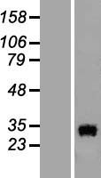 OCEL1 Human Over-expression Lysates NM_024578