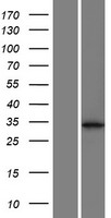 ls079635 ccdc121 human over expression lysates nm 024584 wb testing 1