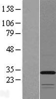 TMEM53 Human Over-expression Lysates NM_024587