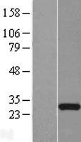 C22orf46 Human Over-expression Lysates NM_024588