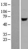 Arylsulfatase J (ARSJ) Human Over-expression Lysates NM_024590