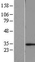 CHMP6 Human Over-expression Lysates NM_024591
