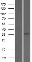 SRD5A3 Human Over-expression Lysates NM_024592
