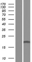 EFCAB1 Human Over-expression Lysates NM_001142857