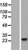 EFCAB1 Human Over-expression Lysates NM_024593
