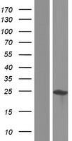 AKIRIN1 Human Over-expression Lysates NM_024595
