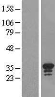 C16orf57 (USB1) Human Over-expression Lysates NM_024598