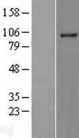 RHBDF2 Human Over-expression Lysates NM_024599