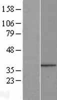PPP1R3B Human Over-expression Lysates NM_024607