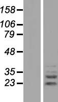 PLEKHF2 Human Over-expression Lysates NM_024613