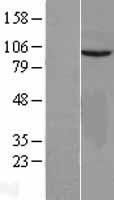 VEPH1 Human Over-expression Lysates NM_024621