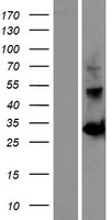 OGFOD2 Human Over-expression Lysates NM_024623