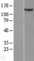 SMC6L1 (SMC6) Human Over-expression Lysates NM_024624