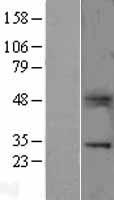 B7H4 (VTCN1) Human Over-expression Lysates NM_024626