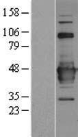 RTL10 Human Over-expression Lysates NM_024627