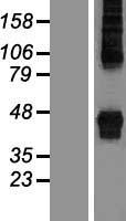 ZDHHC14 Human Over-expression Lysates NM_153746