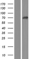 ls079695 galnt12 human over expression lysates nm 024642 wb testing 1