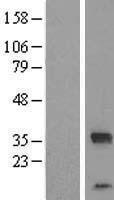 C14ORF140 (ZC2HC1C) Human Over-expression Lysates NM_001042430