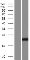 ZMAT4 Human Over-expression Lysates NM_001135731