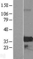 ZMAT4 Human Over-expression Lysates NM_024645