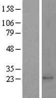 PRKRIP1 Human Over-expression Lysates NM_024653