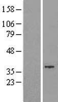 GTDC1 Human Over-expression Lysates NM_024659